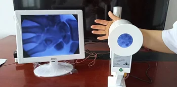 portátil de rayos X